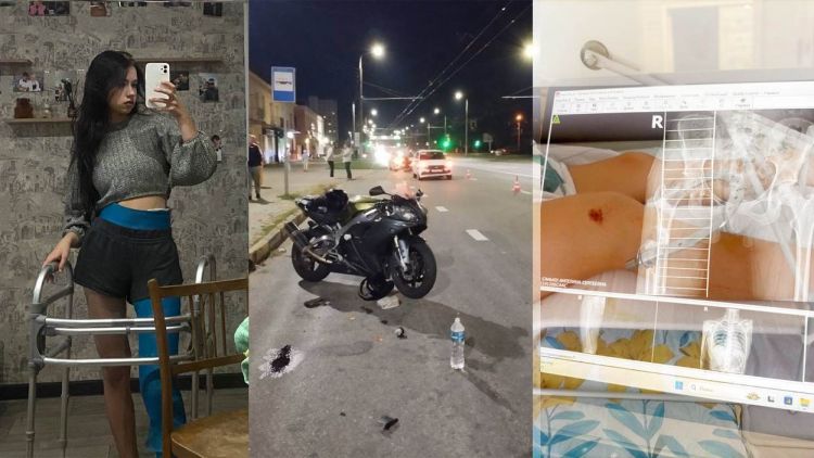 17-летння гомельчанка попала в страшную аварию на мотоцикле, полгода провела в лежачем состоянии. Вдохновляющая история о том, как важно не сдаваться