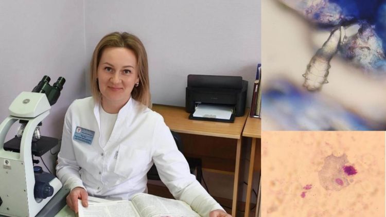 «Бывали забавные находки в мазках – например, пыльца растений». Вместе с врачом-цитологом заглянули в человеческий «микрокосмос» и узнали, какие в нем обитают «нелегалы»